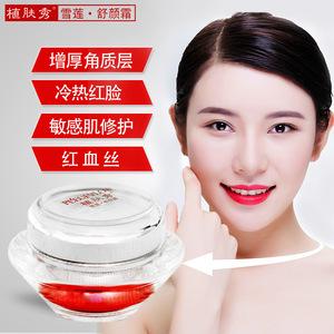 {娛樂城}(祛红血丝最有效的产品排行榜)
